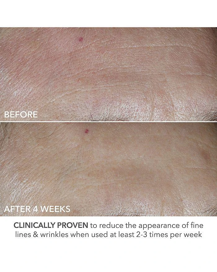 Dr. Dennis Gross Advanced Retinol + Ferulic Perfectly Dosed Retinol Peel (Universal 0.2% Pure Retinol), Set of 8 11