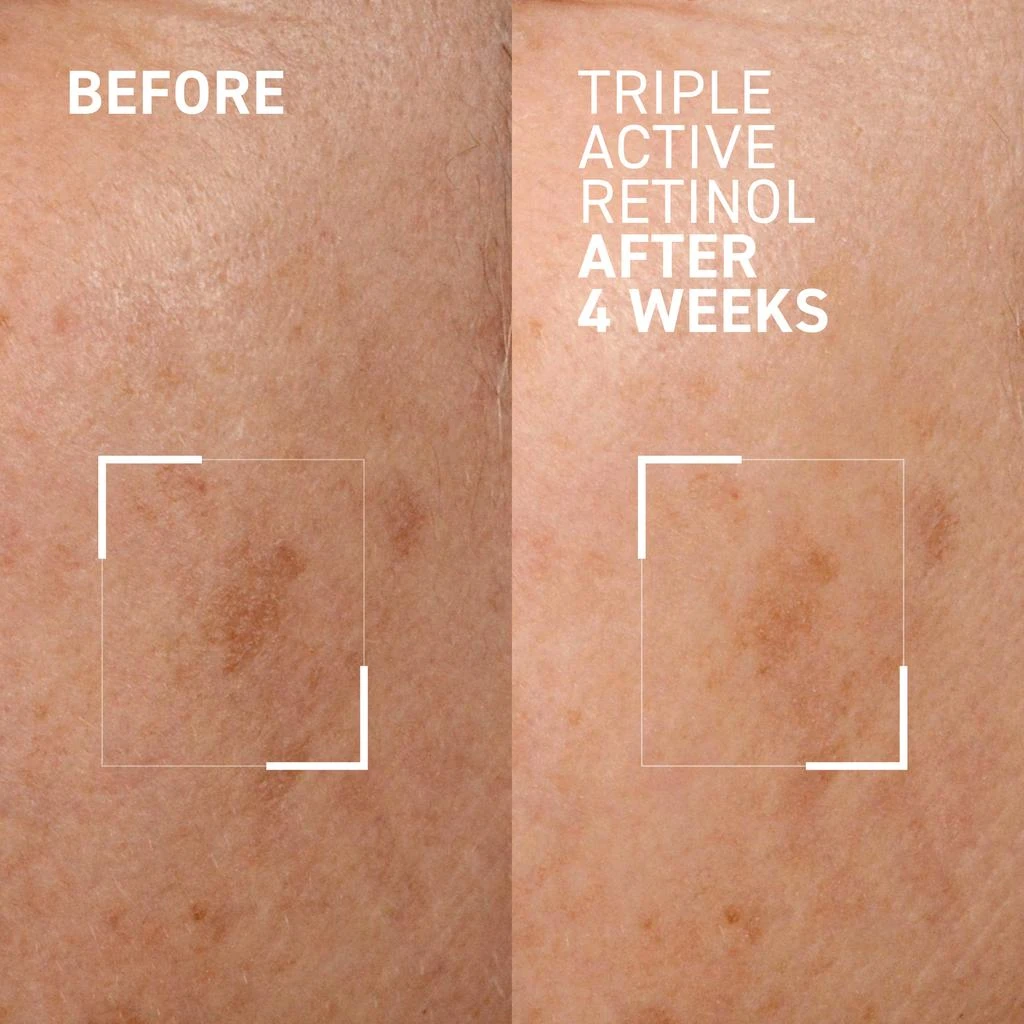 Dr. Brandt Skincare Dr. Brandt Triple Active Retinol 30g 2