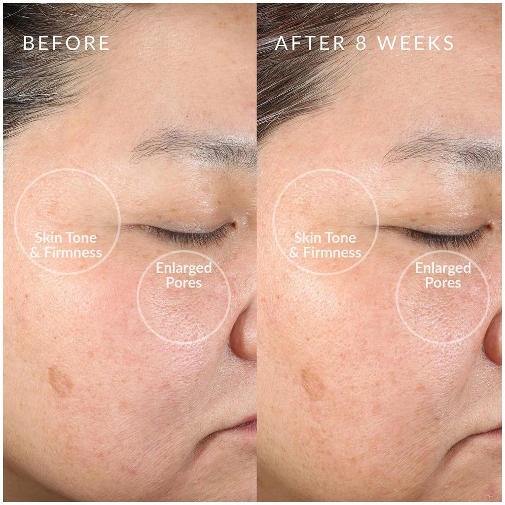 Perricone MD PMD Clean Redvolution Red LED Facial Device 5