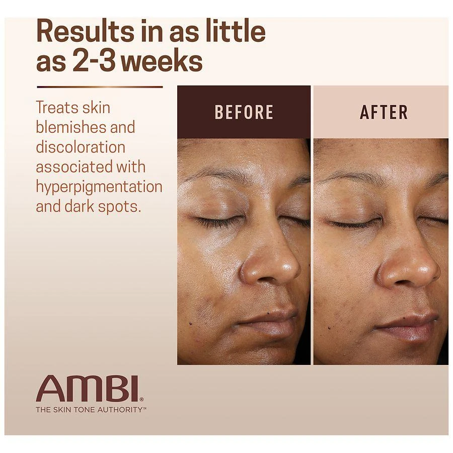 Ambi Even & Clear Fade Cream for All Skin Types 8