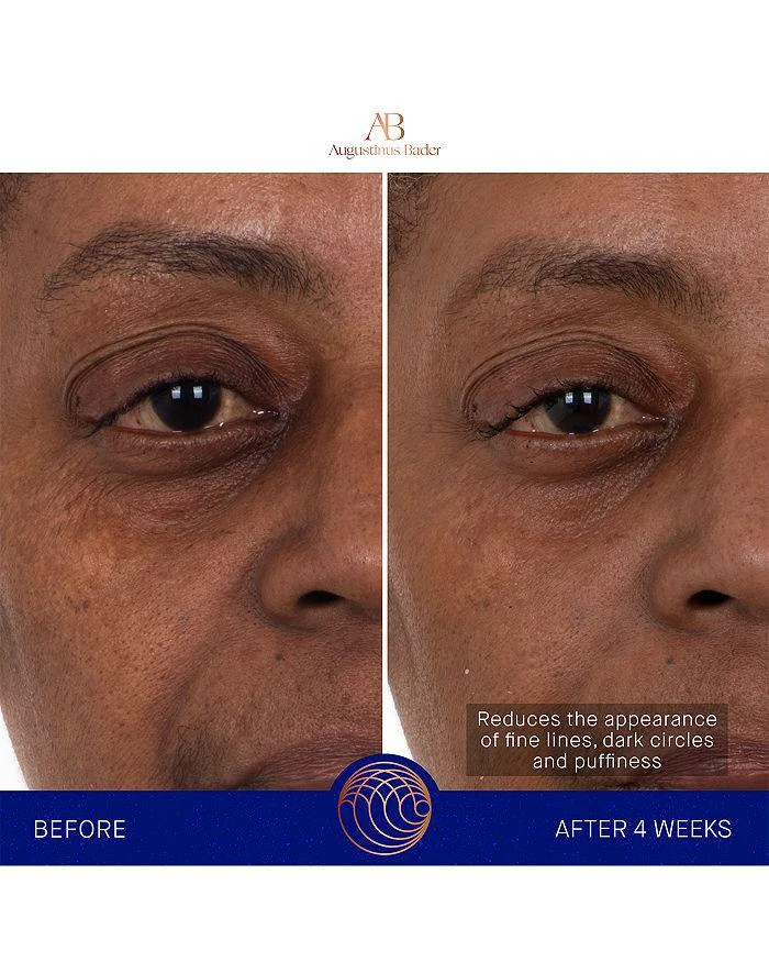 Augustinus Bader The Eye Patches 16