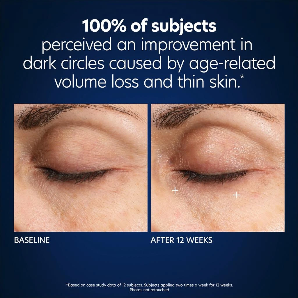 PCA SKIN PCA Skin Hyaluronic Acid Microneedle Eye Patches- 4pack 5