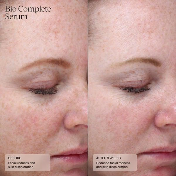 SENTÉ SENTÉ Bio Complete Serum (1 oz.) 4