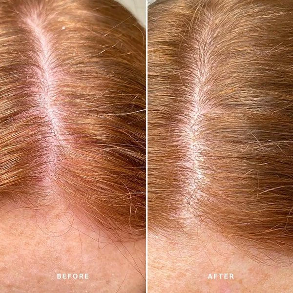 Alpha-H Alpha-H Healthy Scalp Exfoliating Treatment with Australian Desert Lime 100ml 8