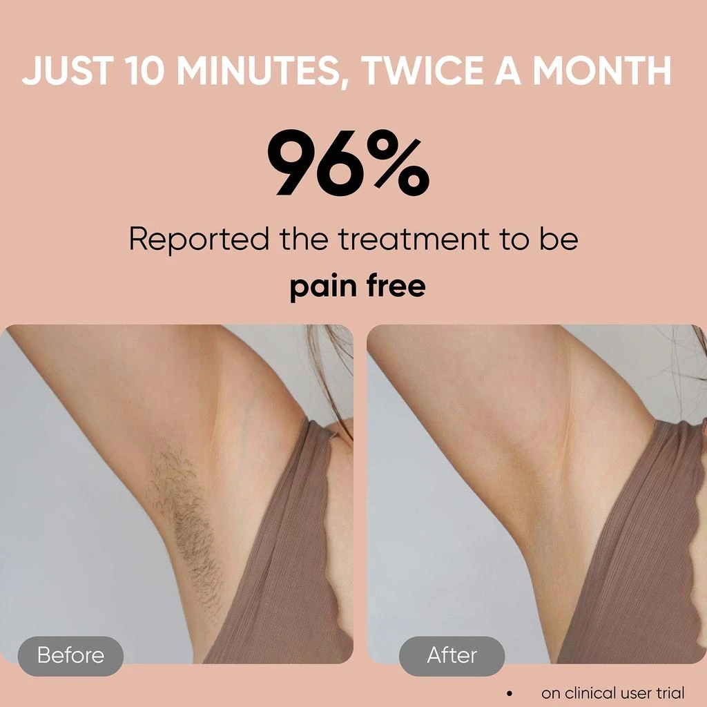 Sensica Sensica Sensilight Pro Cordless IPL 4