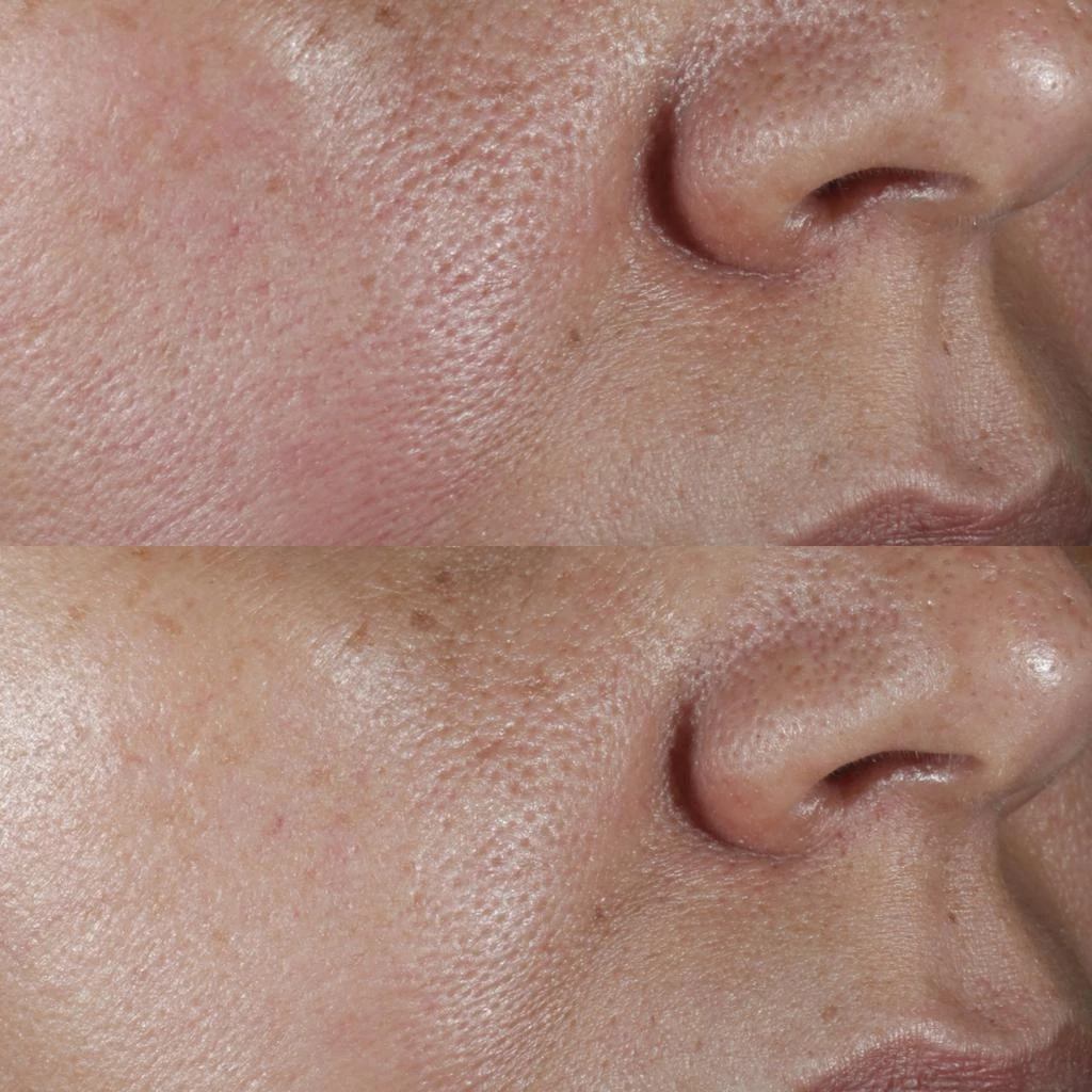 Perricone MD No:Rinse Intensive Pore Minimizing Toner 3