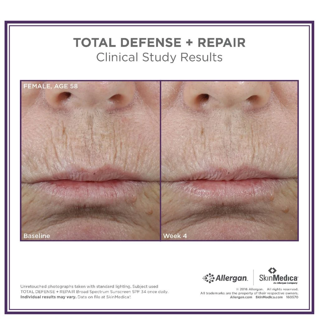 SkinMedica SkinMedica Total Defense Repair SPF 34 - Tinted 3