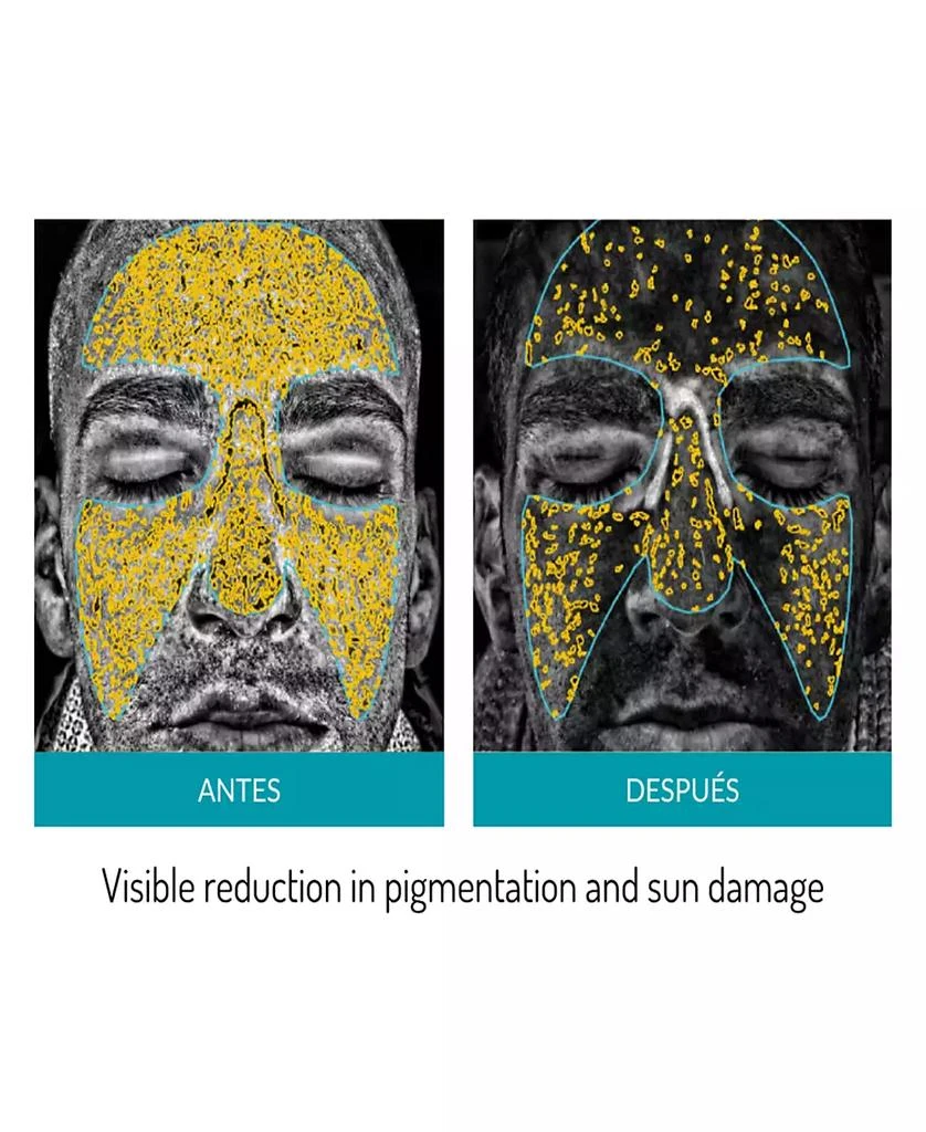 glo Mask LED Phototherapy Mask 10