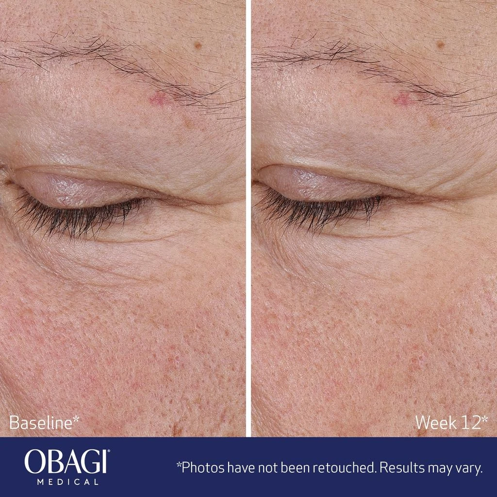 Obagi Medical Obagi Medical ELASTIderm Advanced Filler Concentrate 4