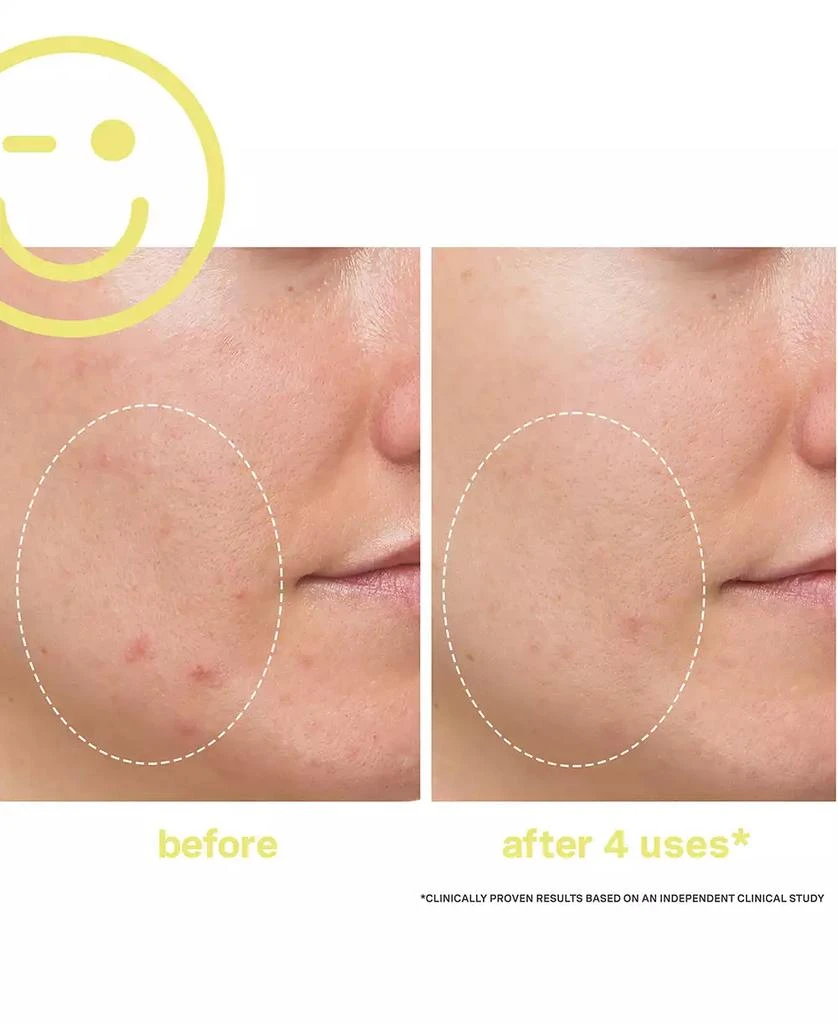 Kate Somerville Mega-C 30% Vitamin C Brightening Facial, 2 oz. 4