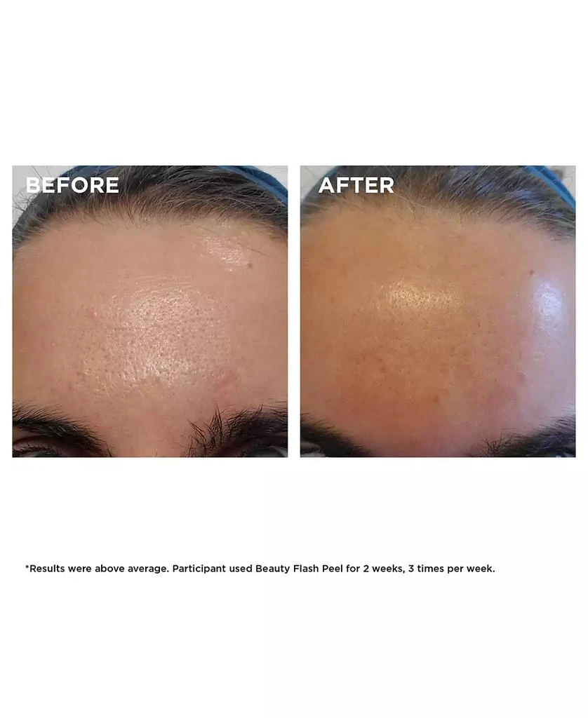 Clarins Beauty Flash Peel with BHA & AHA 7