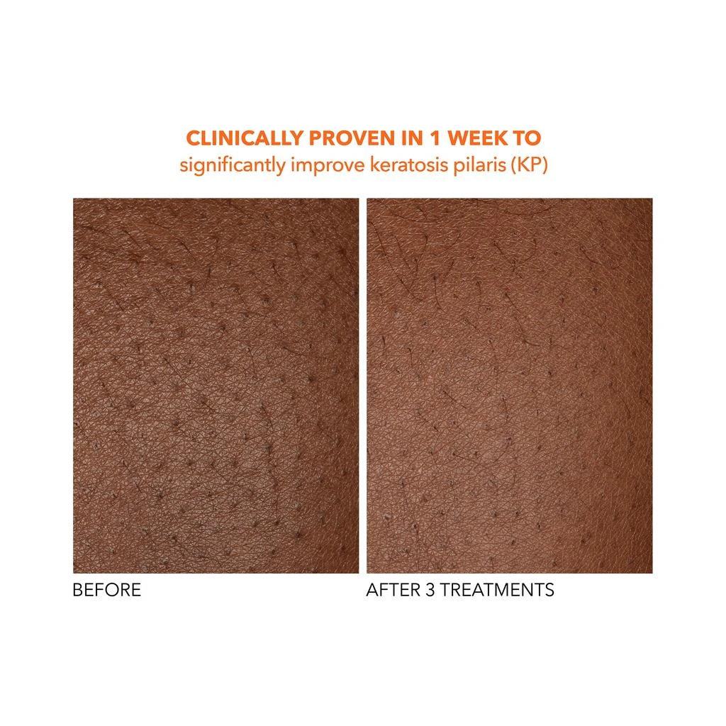 Dr. Dennis Gross Dr Dennis Gross Alpha Beta Universal Daily Peel 8