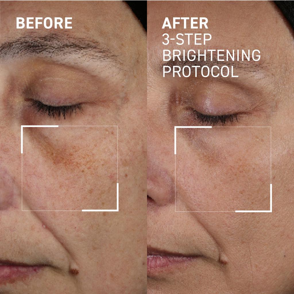 Dr. Brandt Skincare 3-Step Brightening Protocol