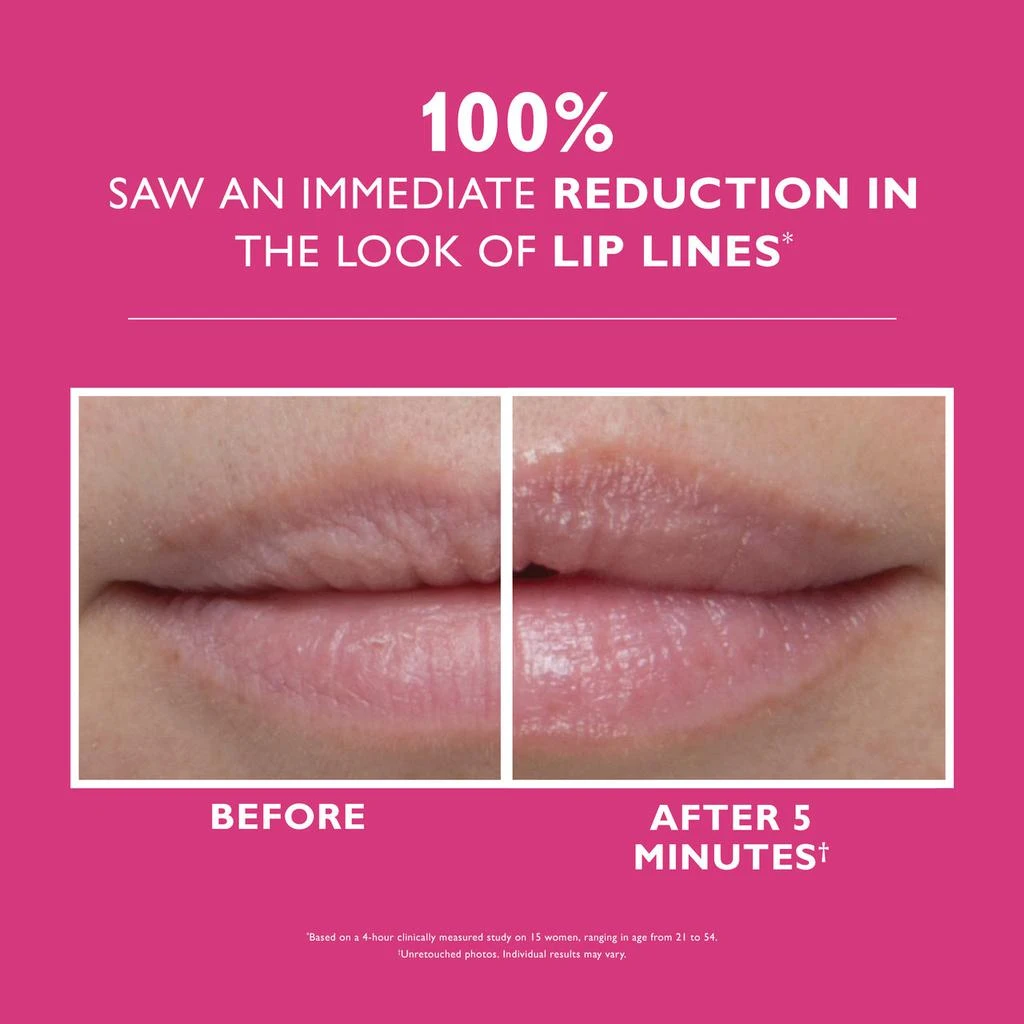 Peter Thomas Roth Instant FIRMx Lip Filler|10 ml / 0.3 fl oz 2