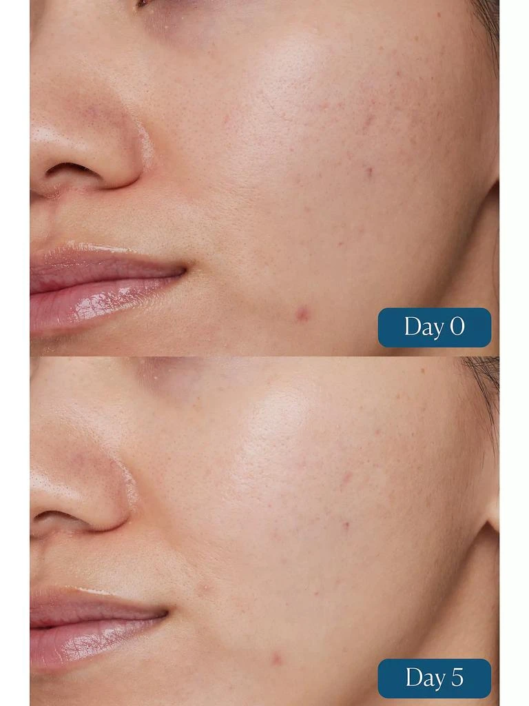 ELEMIS Dynamic Resurfacing Super-C Serum 3