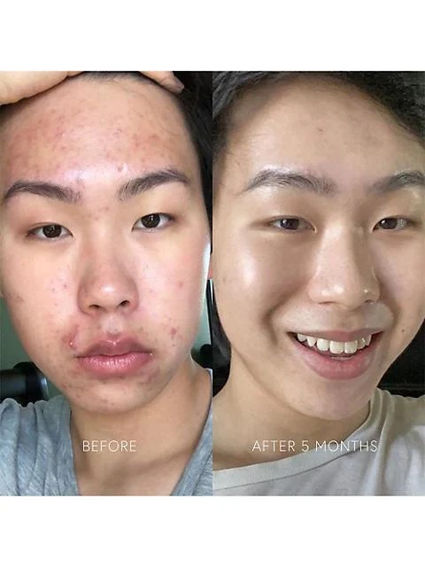 Dr. Barbara Sturm Clarifying Serum 2