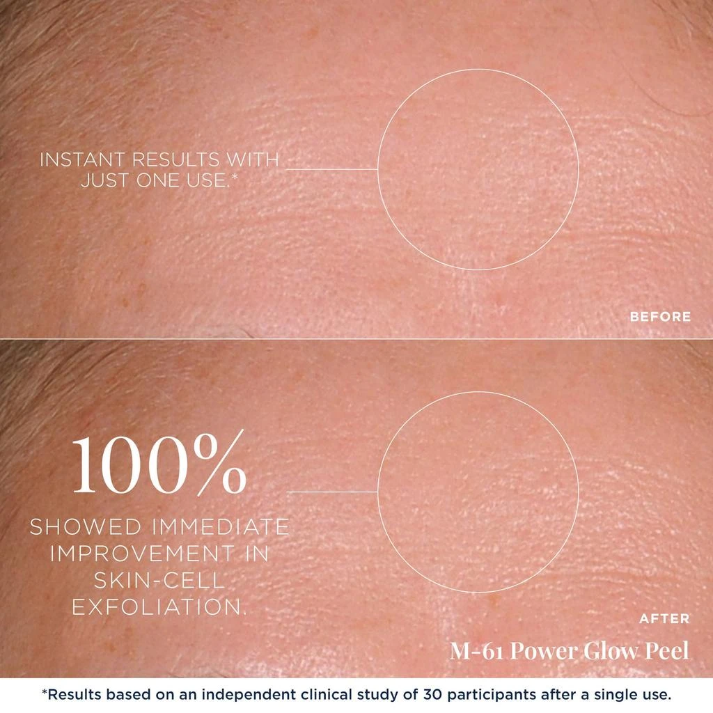 M-61 PowerGlow Peel 3