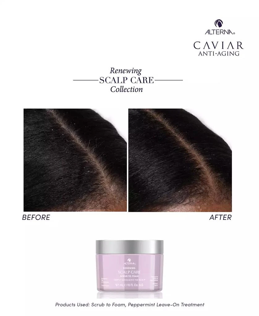 ALTERNA Renewing Scalp Care Scrub To Foam, 6 oz. 13
