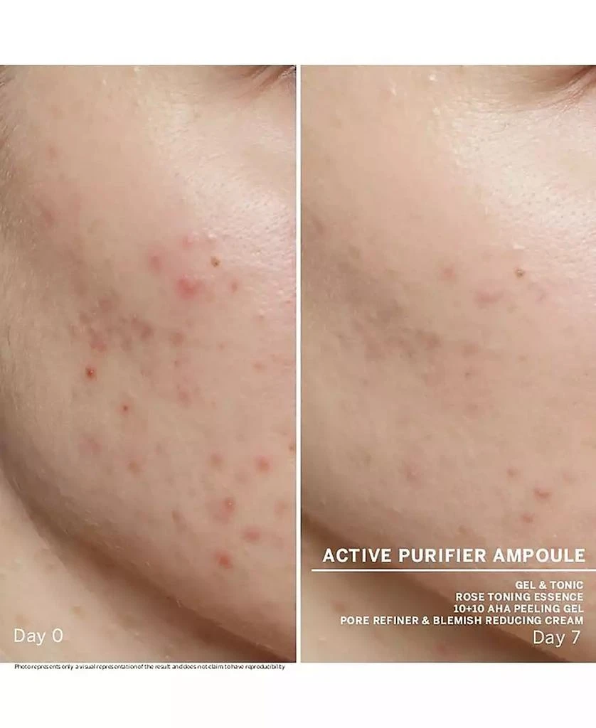 BABOR Active Purifier Ampoule Concentrates 3
