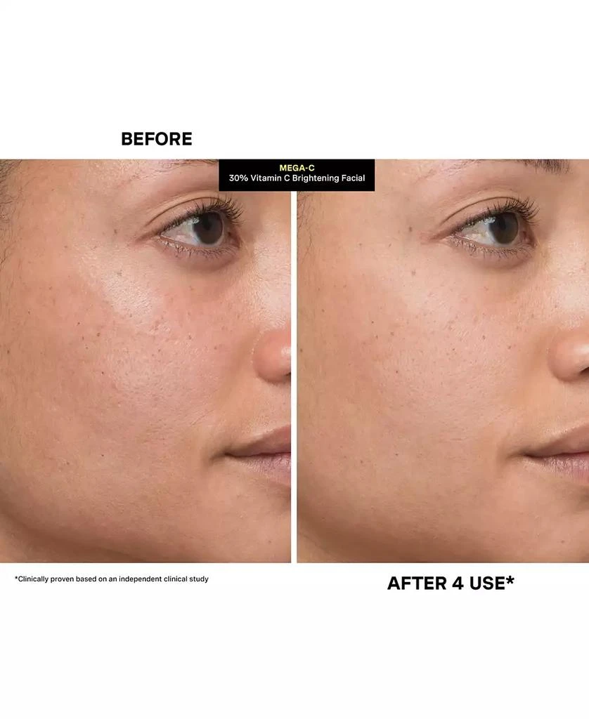 Kate Somerville Mega-C 30% Vitamin C Brightening Facial, 2 oz. 10