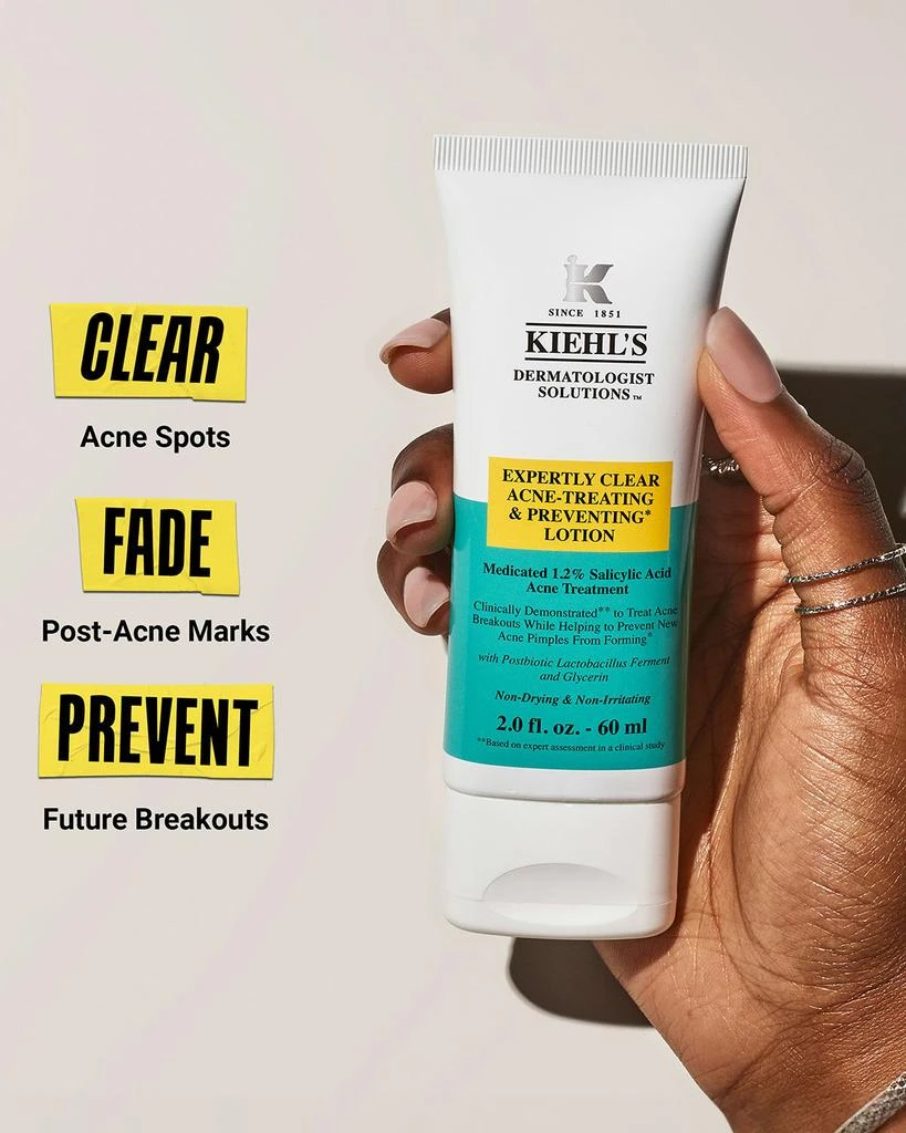 Kiehl's Expertly Clear Acne Treating & Preventing Lotion, 2 oz. 5