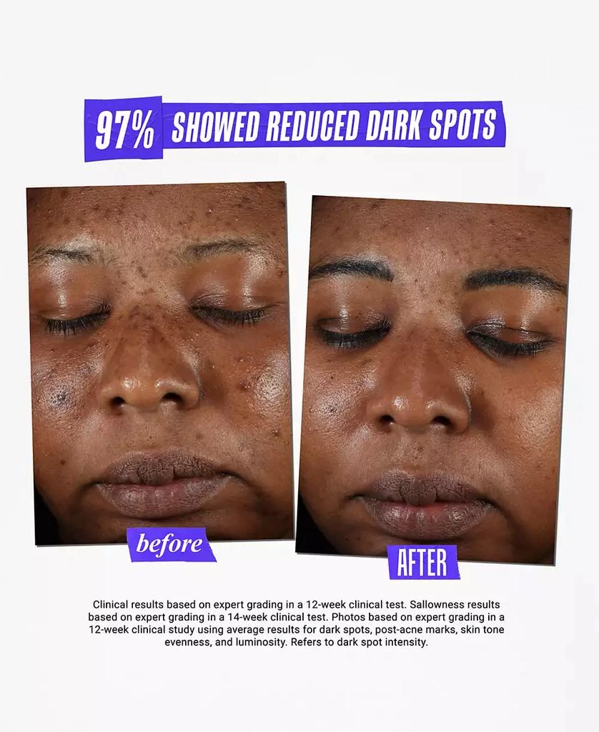 Kiehl's Dermatologist Solutions Clearly Corrective Dark Spot Solution, 3.8 oz. 10