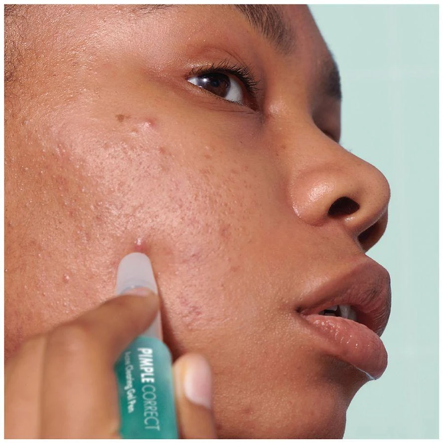 Hero Cosmetics Pimple Correct Acne Clearing Gel Pen 6