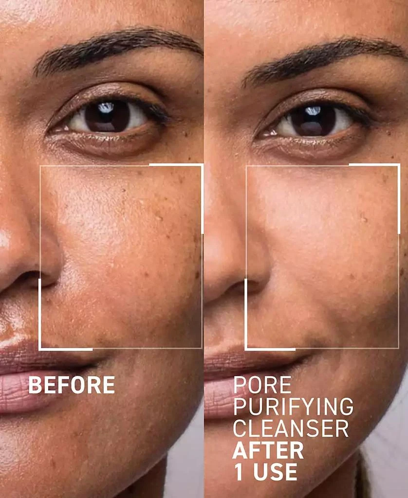 Dr. Brandt Skincare Pores No More Pore Purifying Cleanser 2