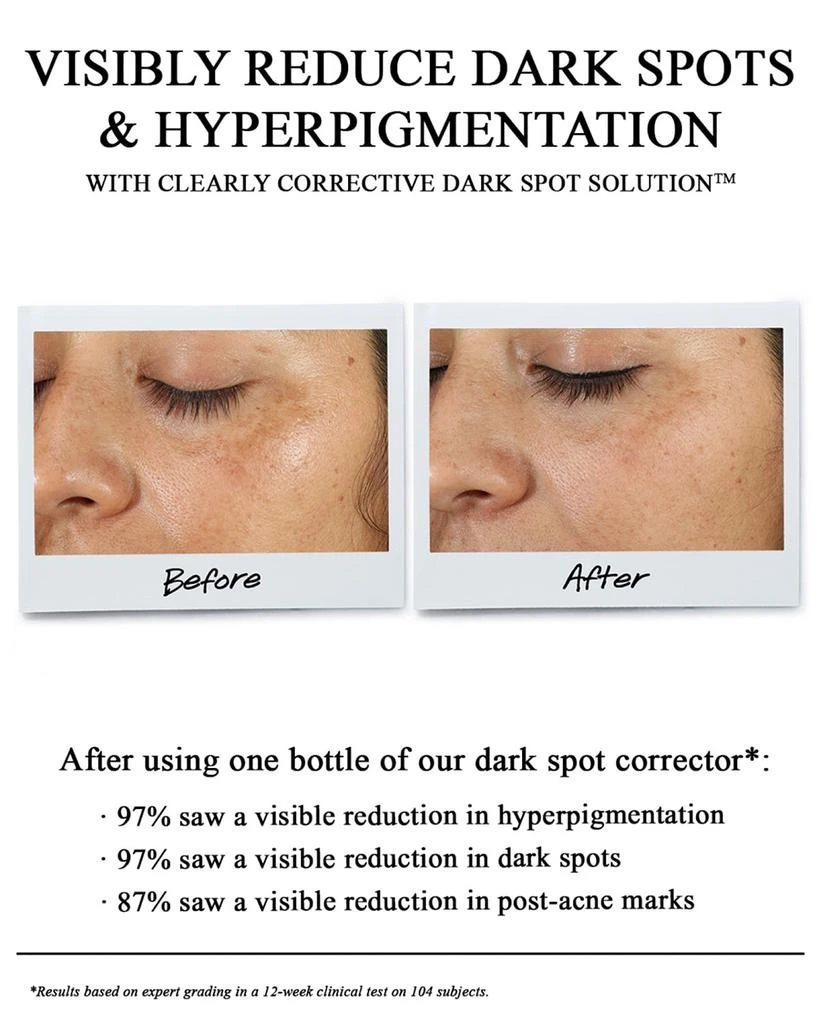 Kiehl's Clearly Corrective Dark Spot Solution 5