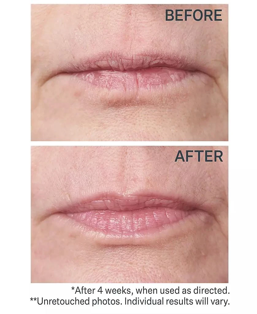 StriVectin Double Fix For Lips Plumping & Vertical Line Treatment, 0.16-oz. 3