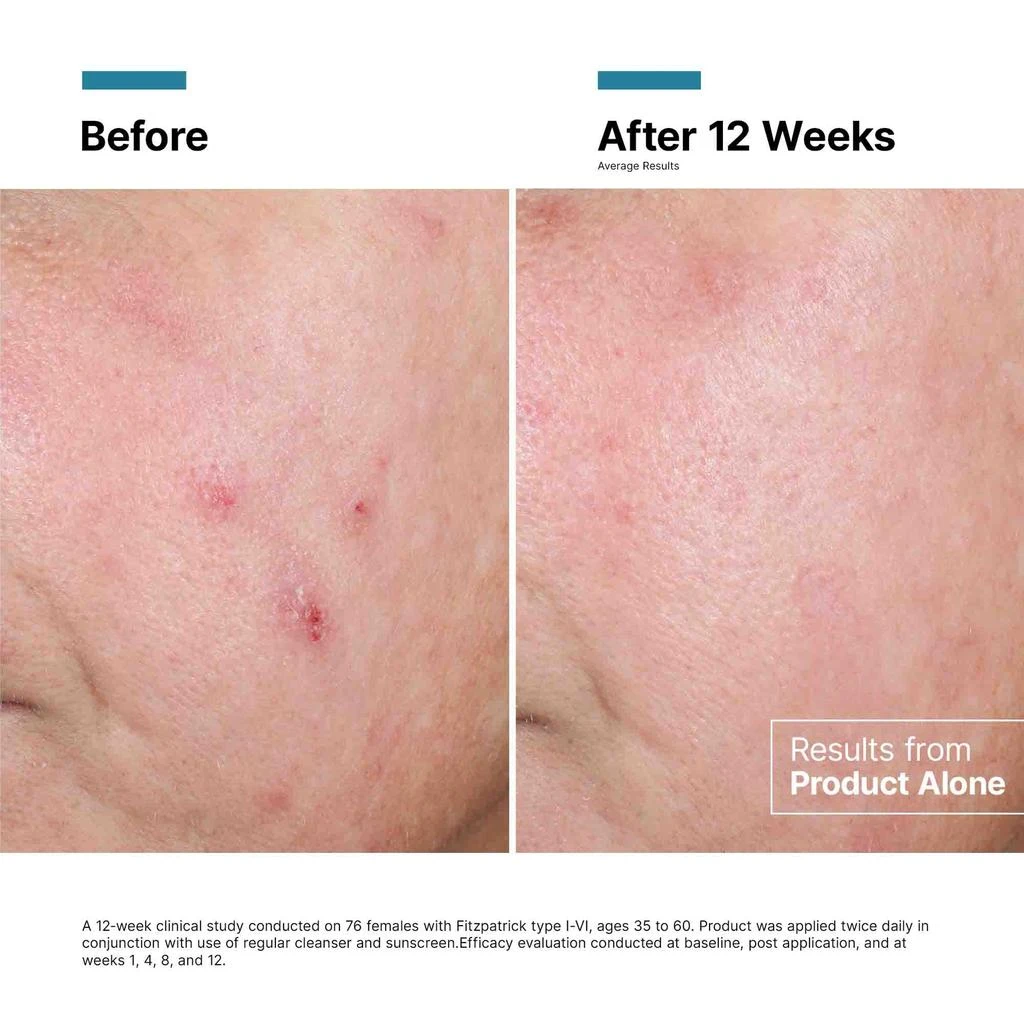 SkinCeuticals SkinCeuticals Advanced RGN-6 Regenerative Cream 5