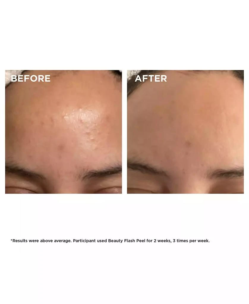 Clarins Beauty Flash Peel with BHA & AHA 3