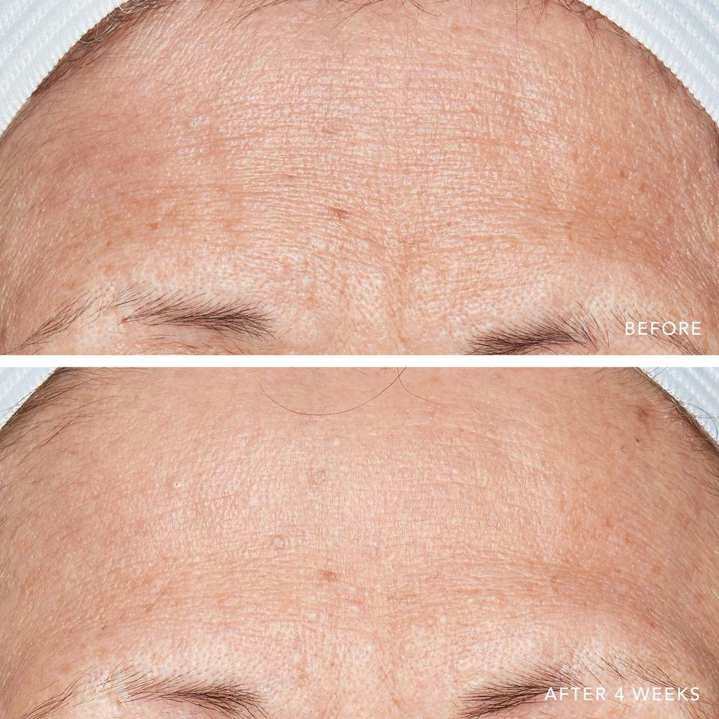 Lancer Skincare Lancer Skincare Advanced Retinol Treatment with 1.25 Retinol 6