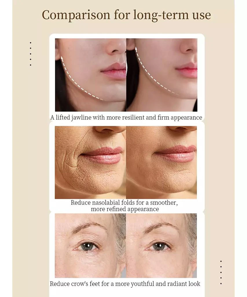 Prospera RF 5 In 1 EMS Micro Current LED Light Beauty Device 9