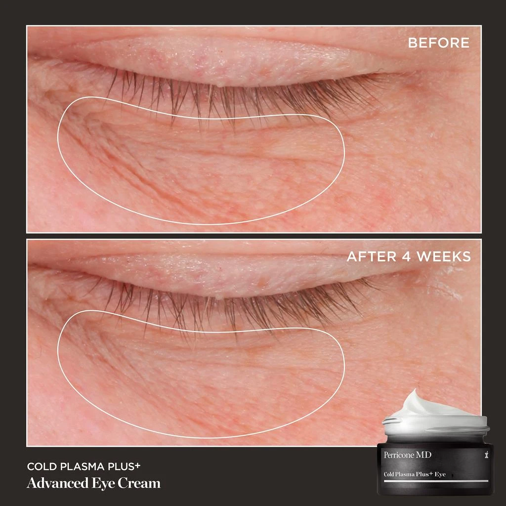 Perricone MD Cold Plasma Plus+ Advanced Eye Cream 2