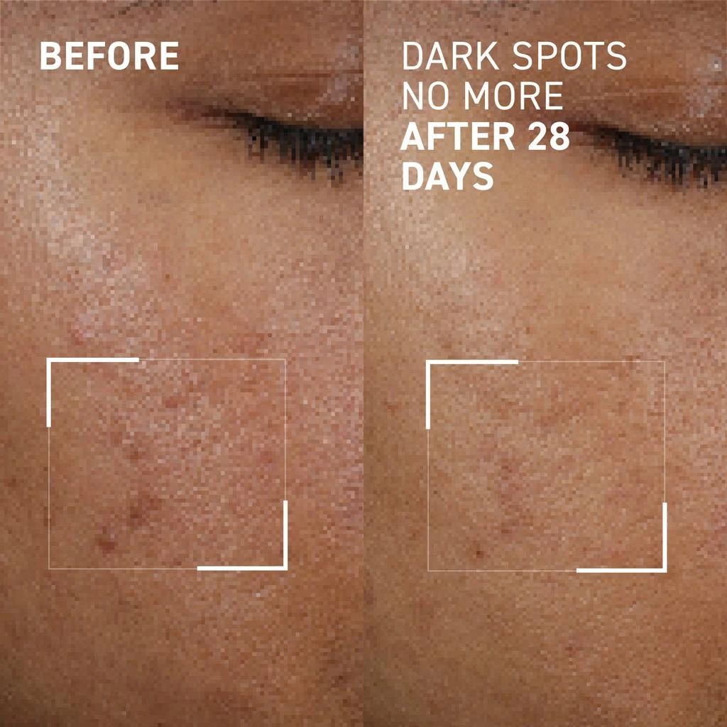 Dr. Brandt DARK SPOTS NO MORE® 3