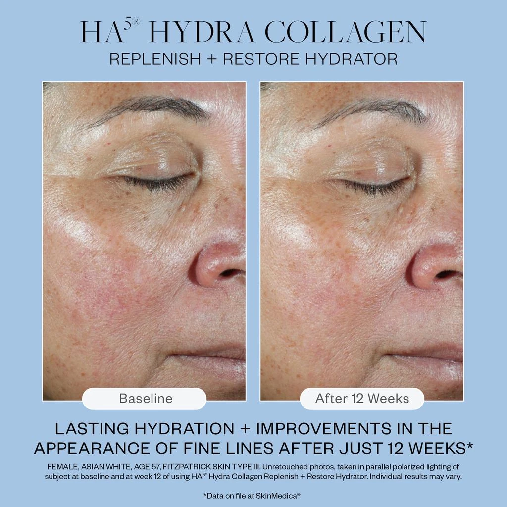 SkinMedica SkinMedica HA5 Hydra Collagen Replenish and Restore Hydrator 9