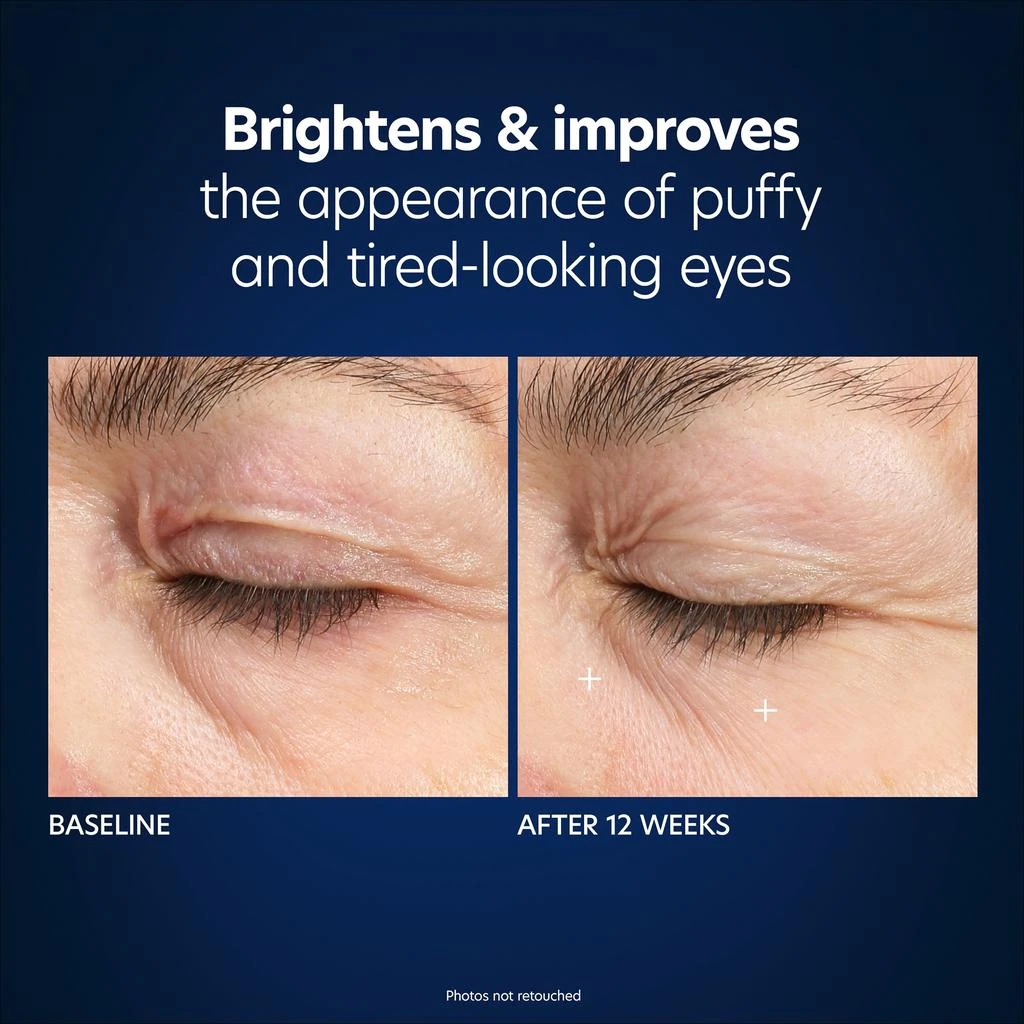 PCA SKIN PCA Skin Hyaluronic Acid Microneedle Eye Patches- 4pack 6