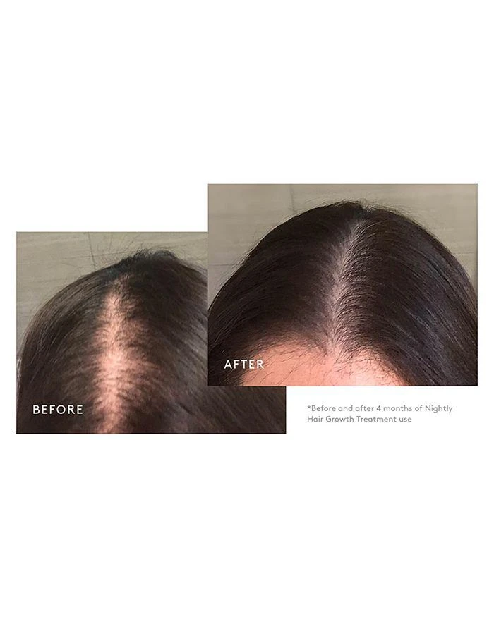 Virtue Flourish Nightly Intensive Hair Growth Treatment - 90 Days 2