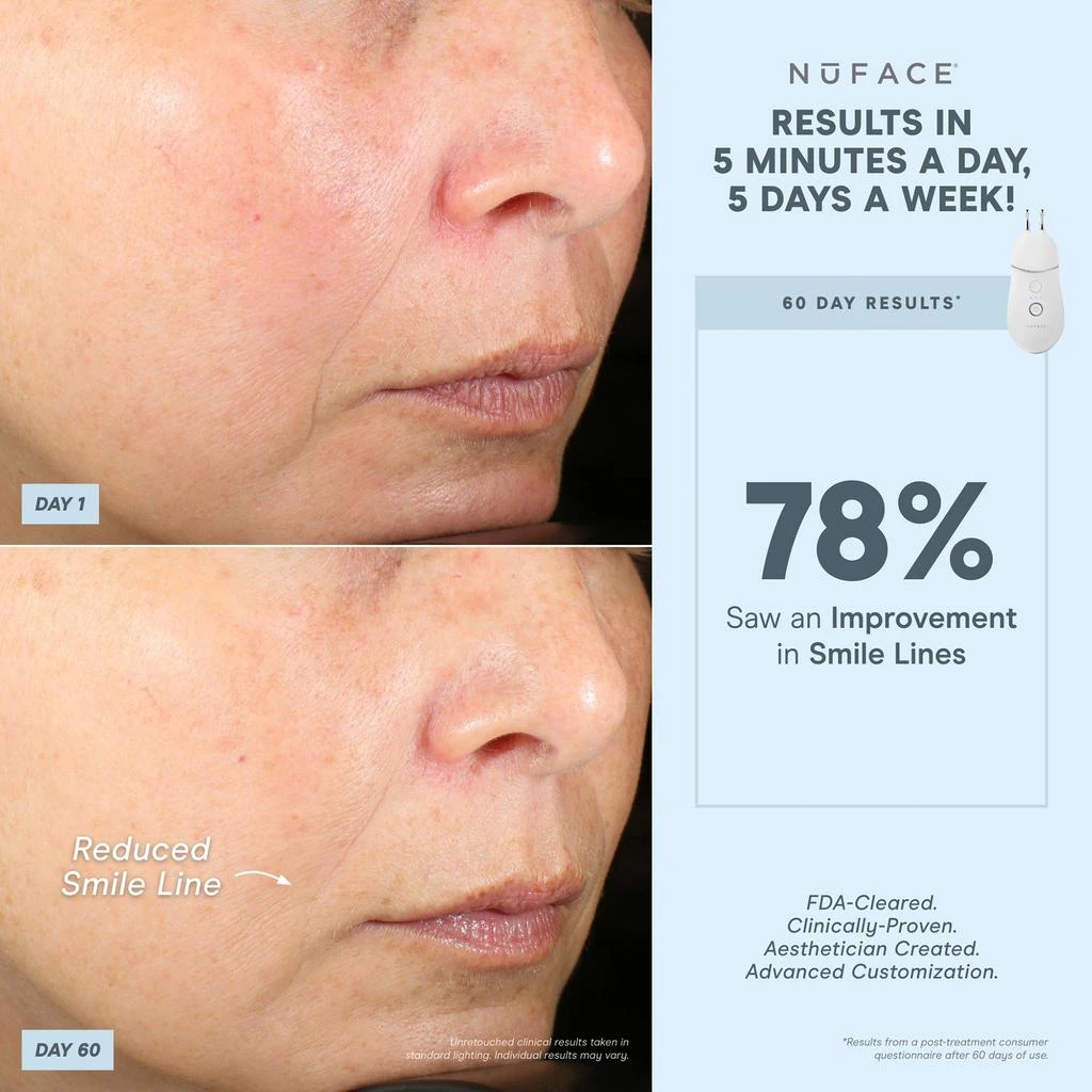 NuFace NuFACE Trinity+ and Effective Lip and Eye Attachment 7