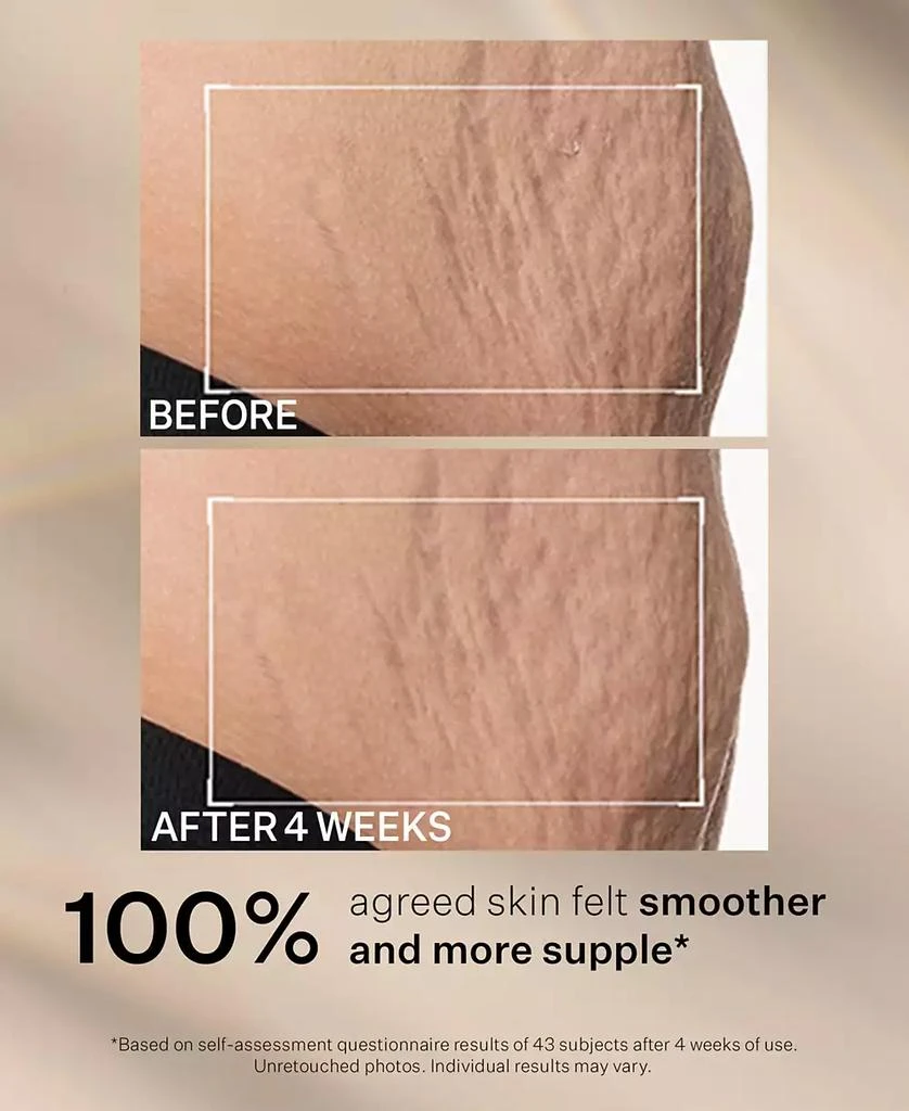 StriVectin SD Advanced Plus Intensive Moisturizer For Wrinkles 
Stretch Marks, 4 oz. 7