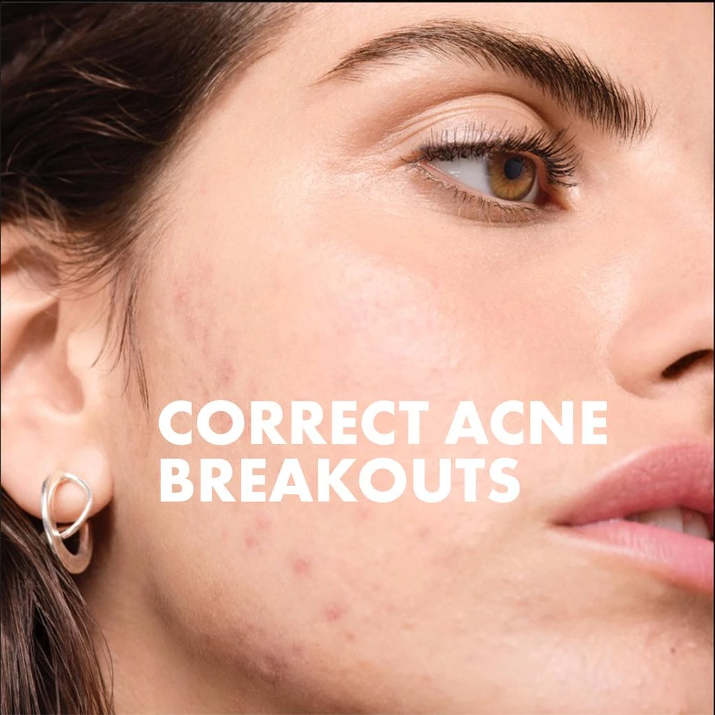 Vichy Vichy Normaderm 3-Step Acne Kit for Oily Skin 4