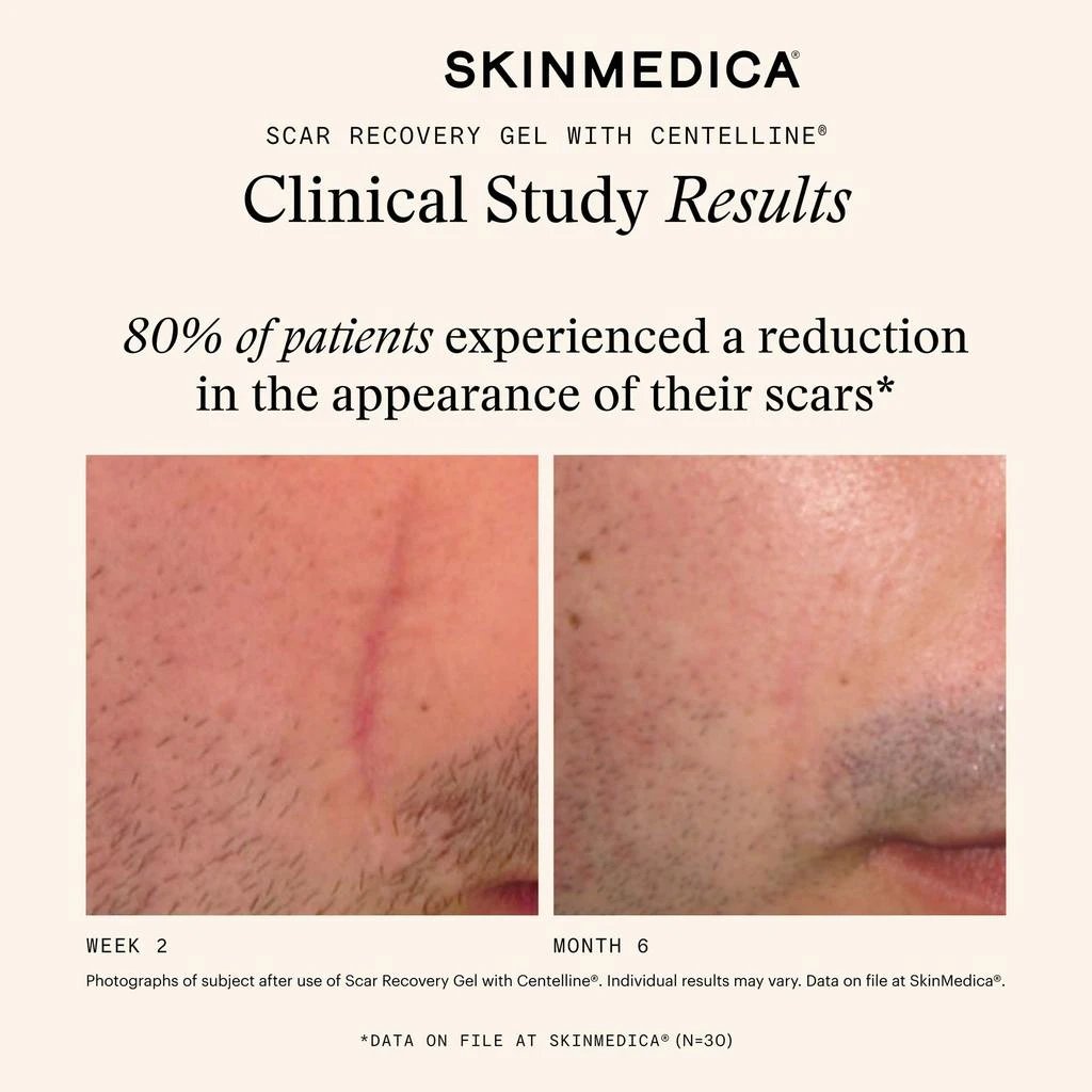 SkinMedica SkinMedica Scar Recovery Gel with Centelline 4