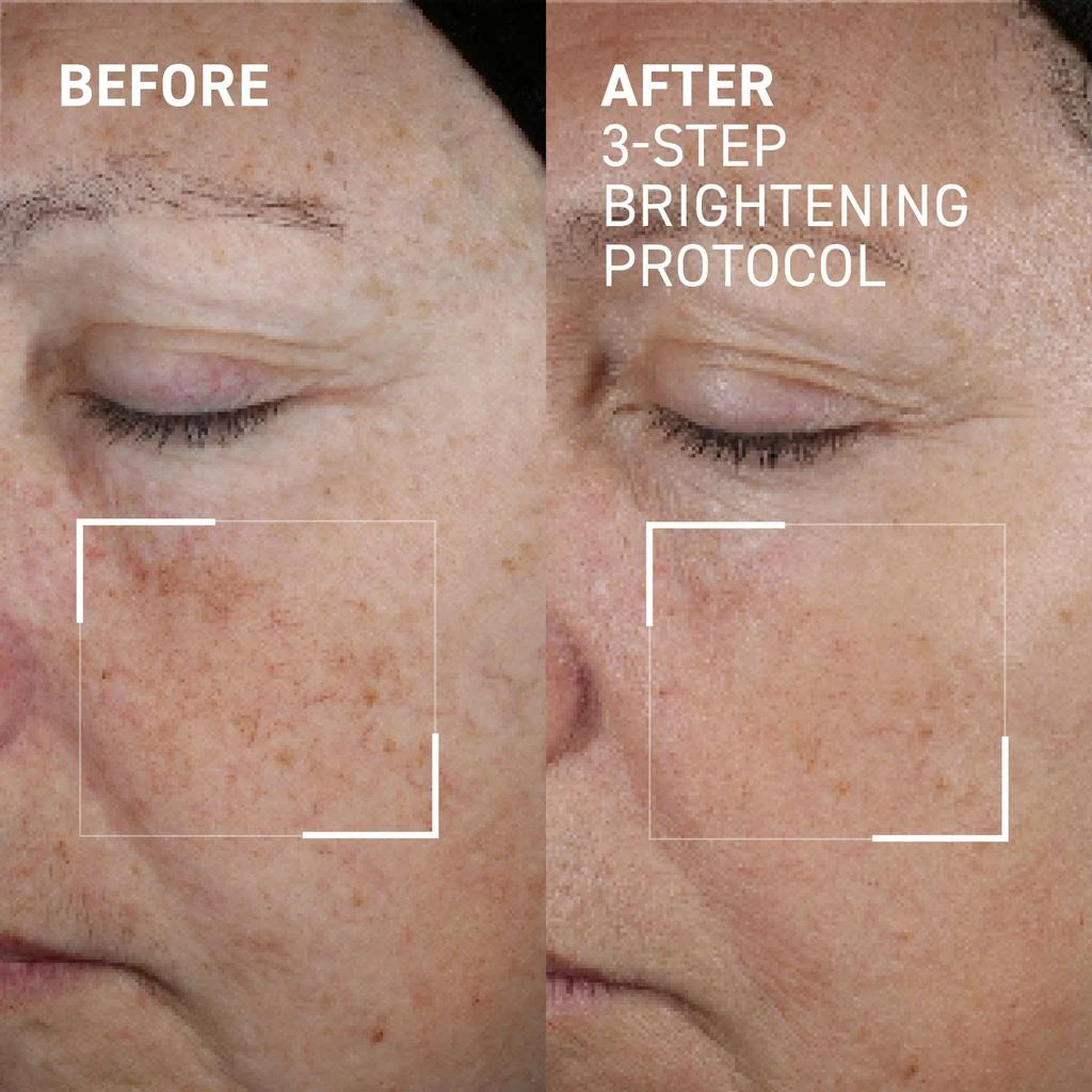 Dr. Brandt 3-Step Brightening Protocol 4