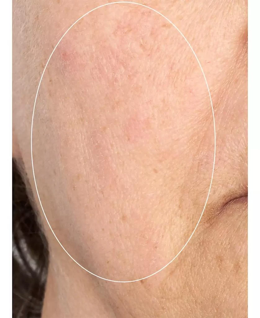 Perricone MD HP Intensive Smoothing Serum, 2.0 oz 5