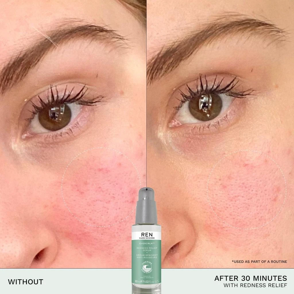 REN Clean Skincare Evercalm™ Redness Relief Serum 3