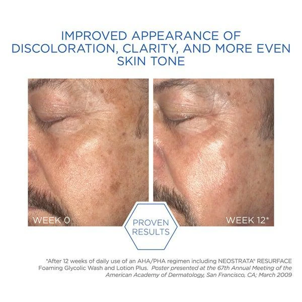 NeoStrata NEOSTRATA Resurface Lotion Plus, 200ml 4