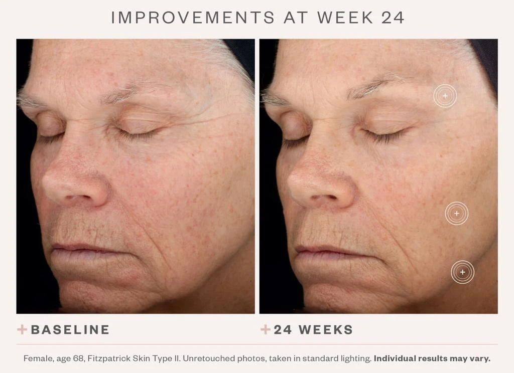 SkinMedica SkinMedica TNS Advanced+ Serum 4