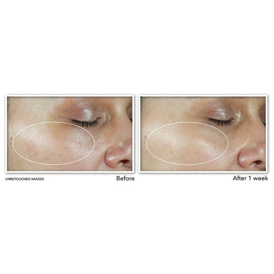RoC Multi Correxion Revive + Glow Moisturizer SPF30 7