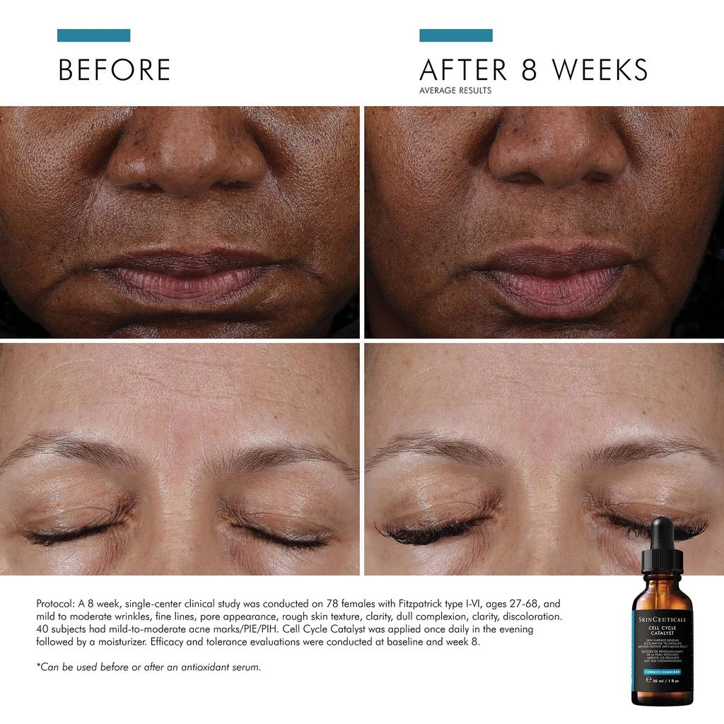 SkinCeuticals SkinCeuticals Age-Defy Essentials Booster Set 6